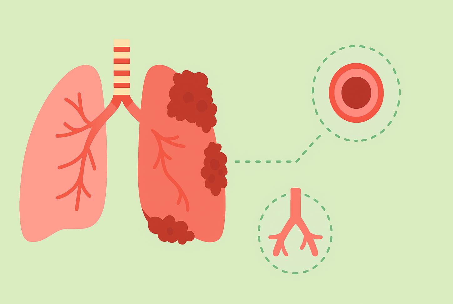Learn about COPD